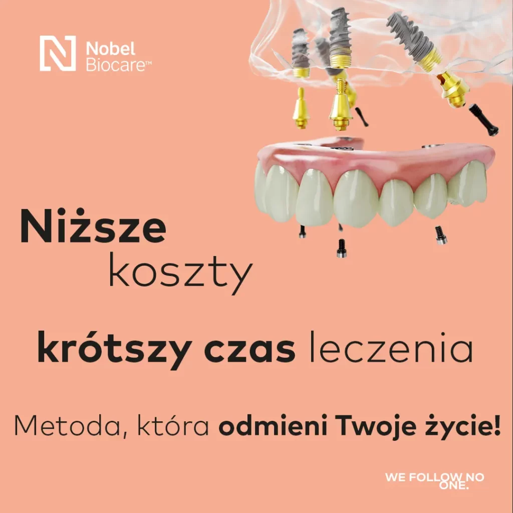 all on 4 upper krótszy czas 1